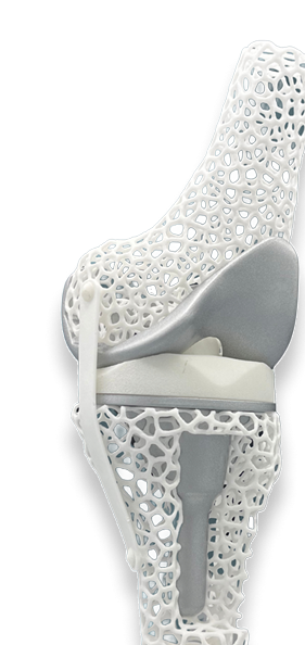 total joints