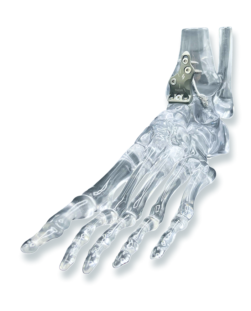 Bone Architecture